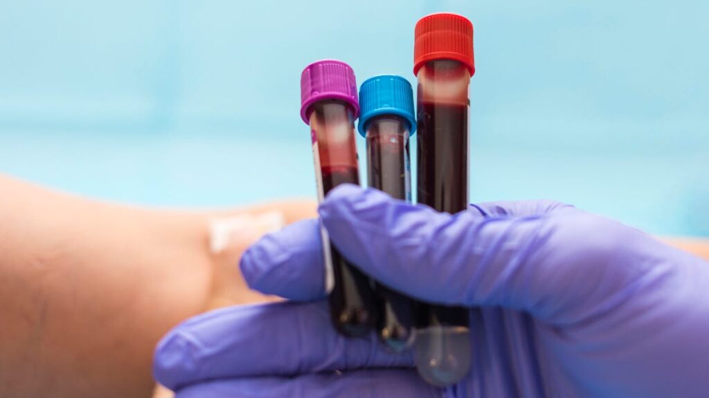 Make sure to be at the top of these 6 blood tests while monitoring your health
