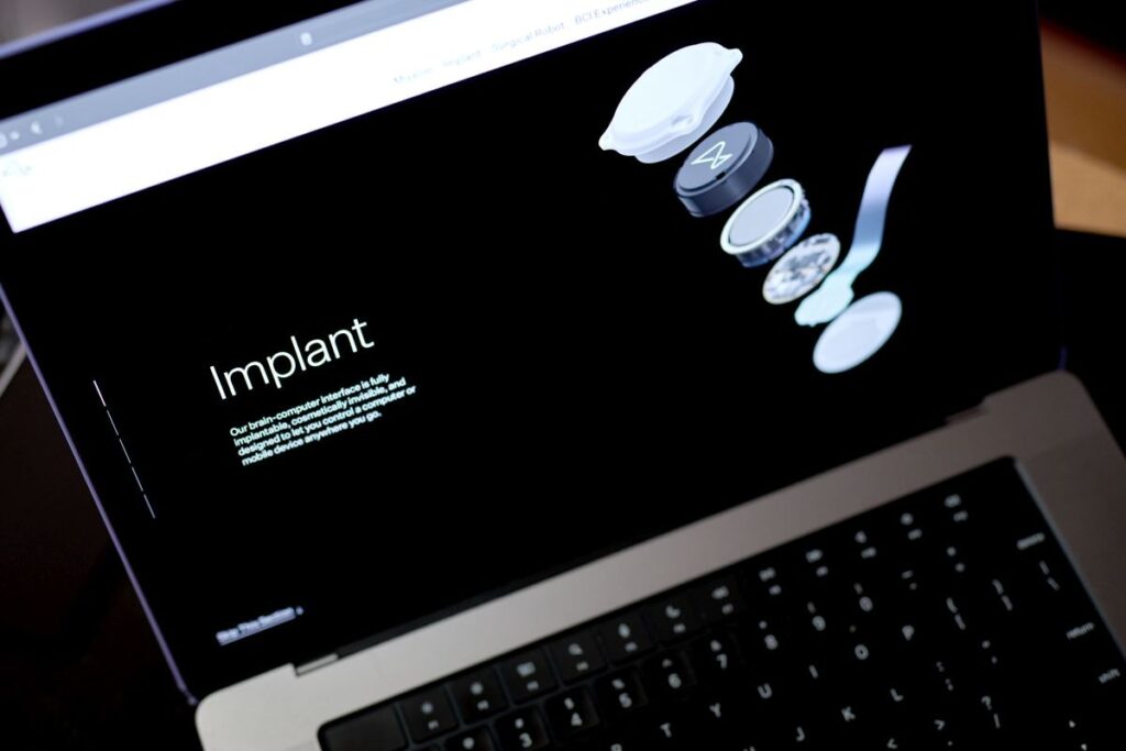 Neurlink device helps the monkey see something that is not there